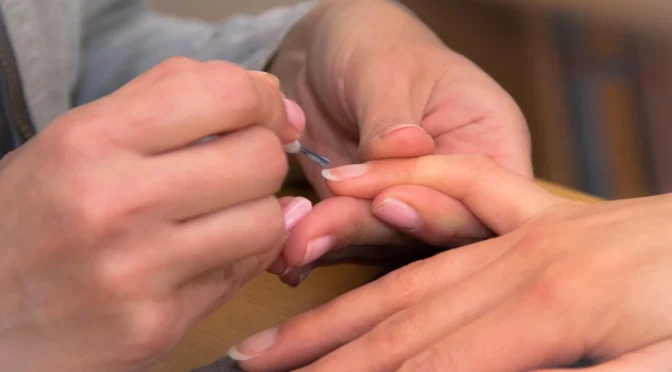 Discover the Secret to Healthy Nails: Top Polish Clinic and Doctors in the UK